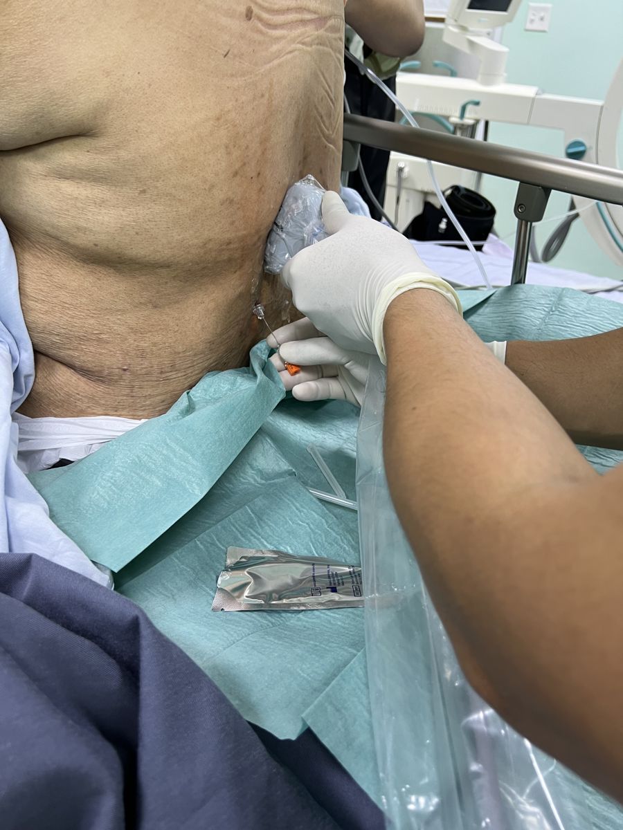 Procedimiento ambulatorio con guía por imágenes